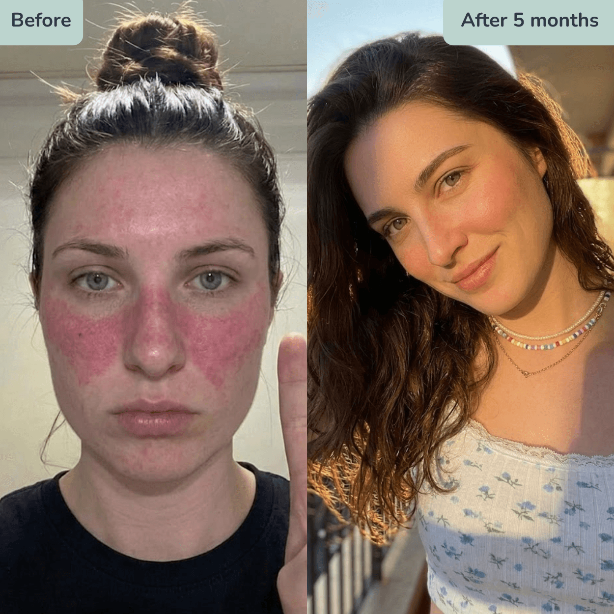 Before and after using a custom prescription formula