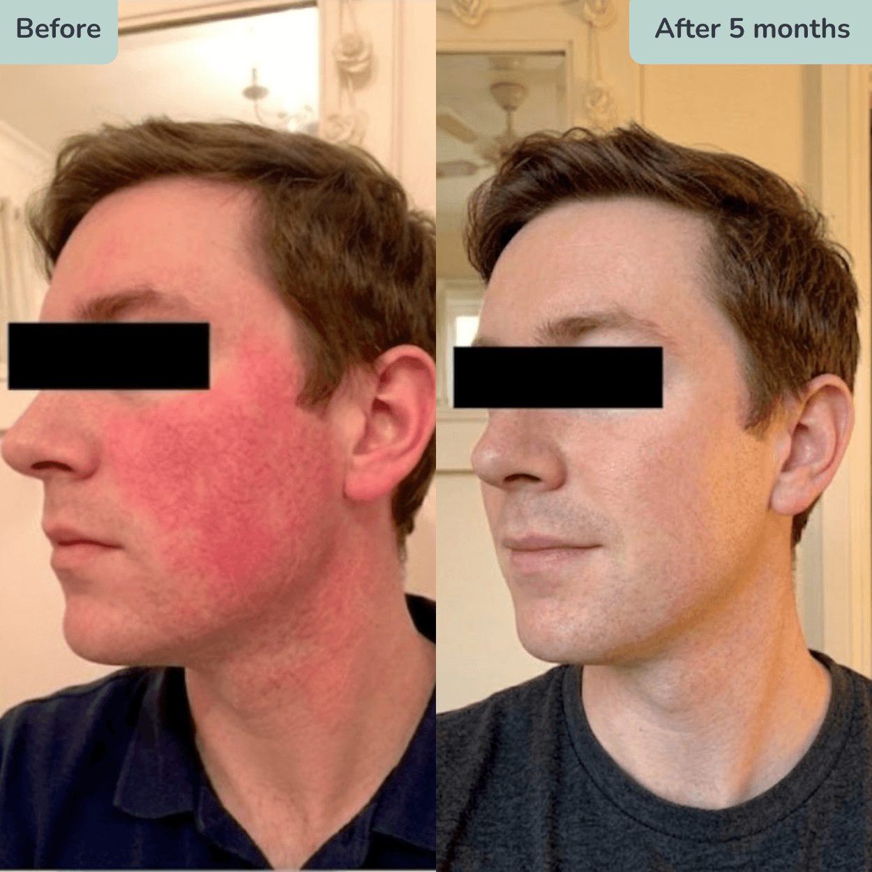Before and after using a custom prescription formula