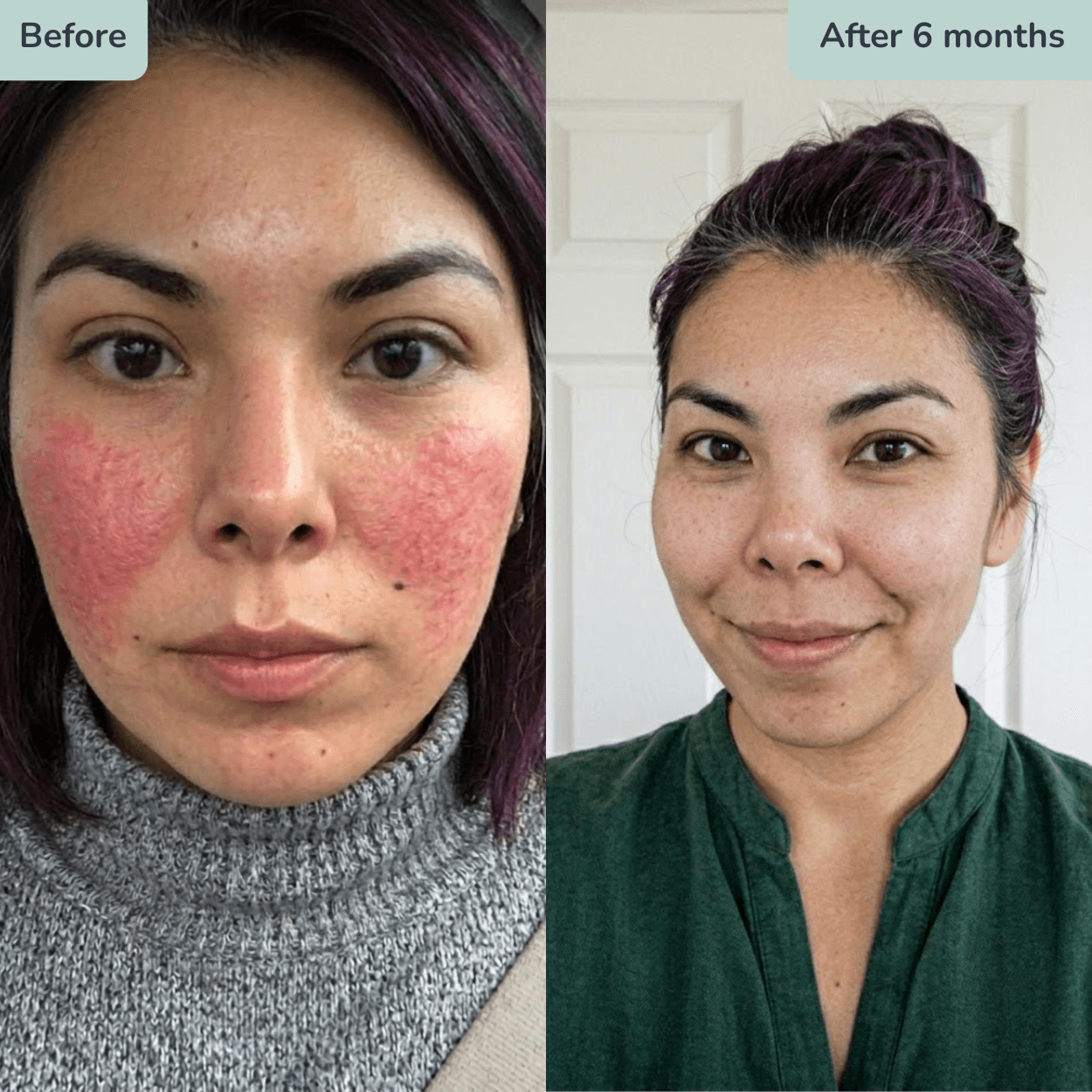 Before and after using a custom prescription formula