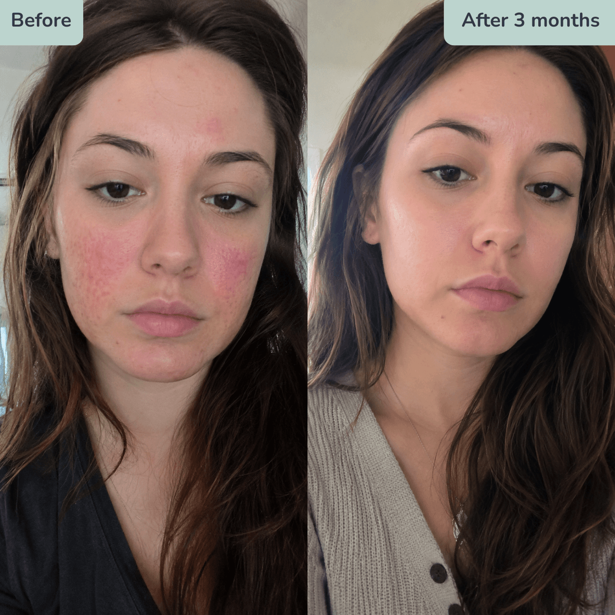 Before and after using a custom prescription formula
